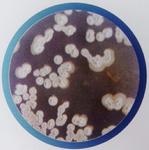 侧孢短芽孢杆菌